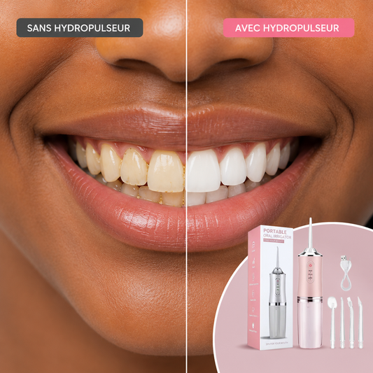 Hydropulseur OralJet™ – Le nettoyage profond que votre brosse à dents ne fait pas 💦🦷