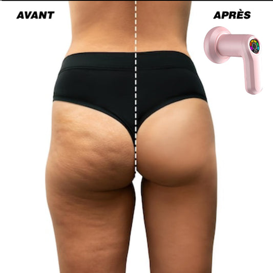 CelluKiller PRO – Le marteau anti-cellulite