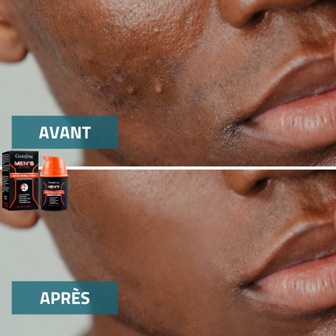 Lotion Visage Hommes + BROSSE ÉLECTRIQUE OFFERTE : Adieu les imperfections, l'acné, le visage terne et les rides