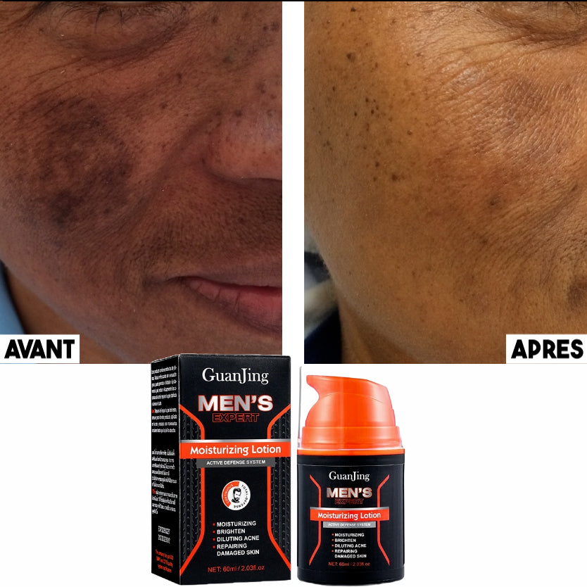 Lotion Visage Hommes + BROSSE ÉLECTRIQUE OFFERTE : Adieu les imperfections, l'acné, le visage terne et les rides